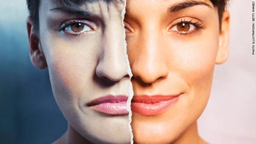 Yaşa Göre Bipolar Bozukluk